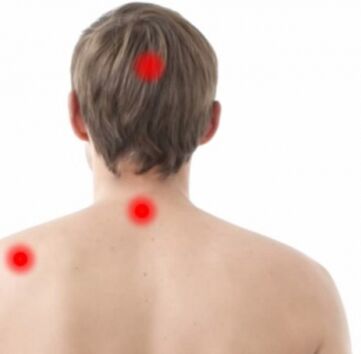 Mund der Osteocondrose