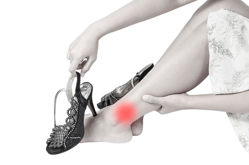 Schmerzen im Sprunggelenk aufgrund von Arthrose