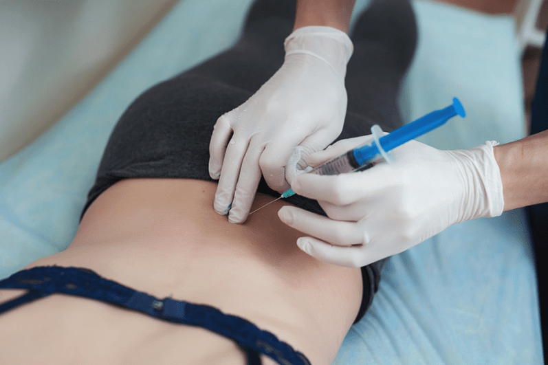 Blockade bei lumbaler Osteochondrose